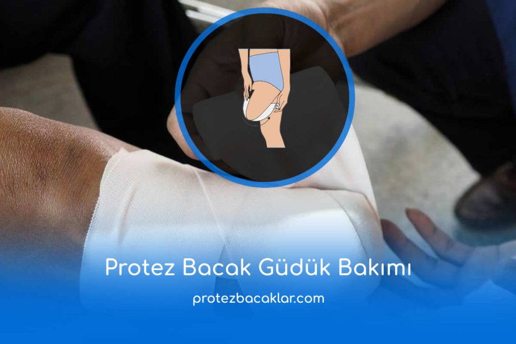 Protez Bacak Güdük Bakımı Nasıl Yapılır