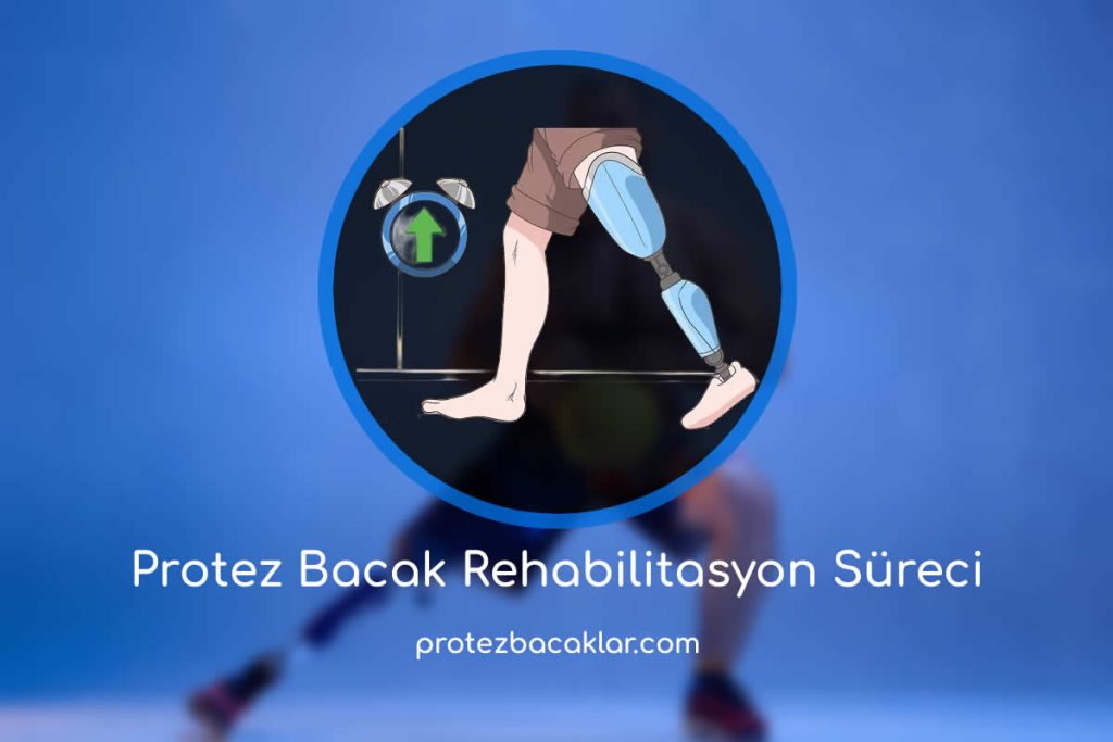 Protez Bacak Rehabilitasyon Süreci