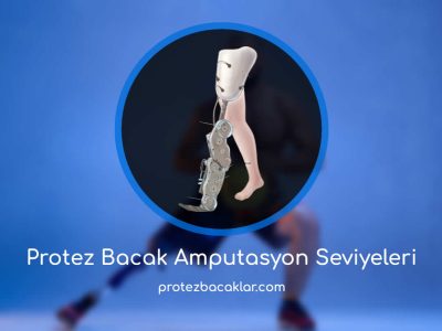 Protez Bacak Amputasyon Seviyeleri