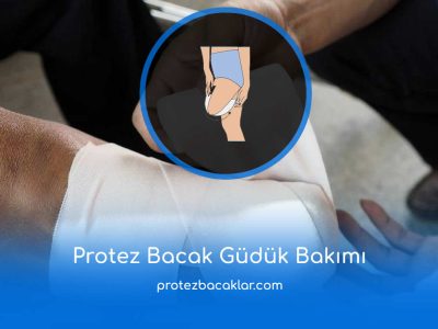 Protez Bacak Güdük Bakımı Nasıl Yapılır
