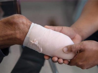Protez Bacak Güdük Kompresyon Uygulaması